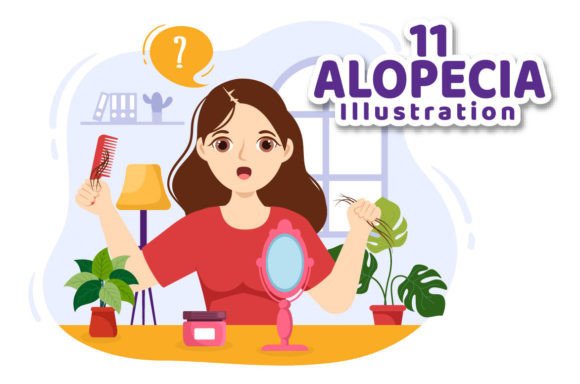 Download 11 Alopecia Hair Loss Illustration - Illustration Collection