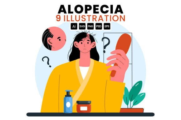 Download 9 Alopecia Hair Loss Illustration - Illustration Collection
